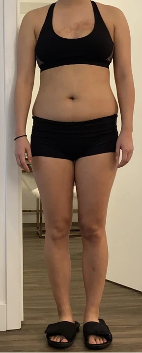 Face-cropped front-view client progress photo, before.