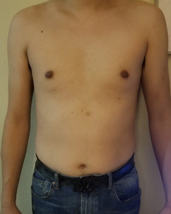 Face-cropped client progress photo, before.