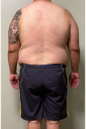 Back-view client progress photo, before.