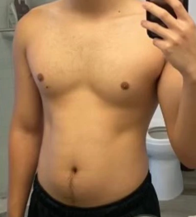 Face-cropped client progress photo, before.