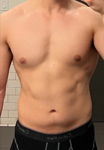 Face-cropped client progress photo, before.